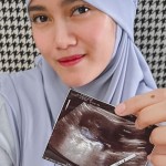 Jessie Amalia-1659486021